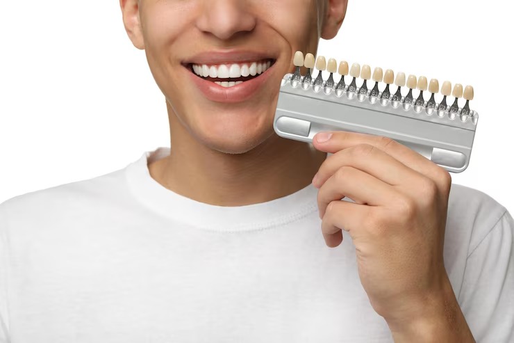 foods drinks to avoid with veneers