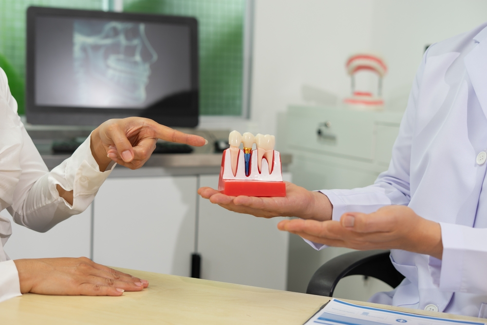 why dental implants are the best tooth replacement option