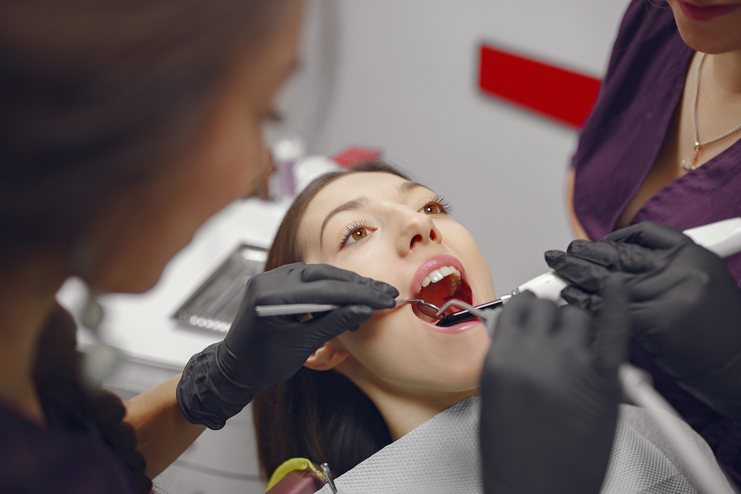 How to Care for Your Teeth After a Dental Filling