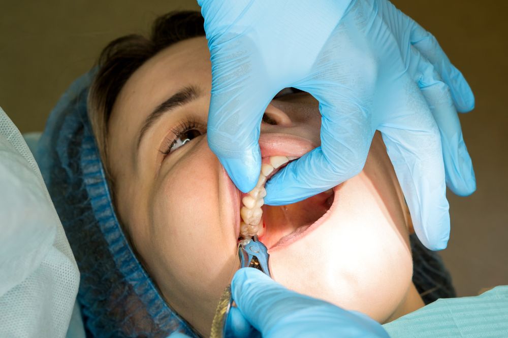 tooth removal treatment